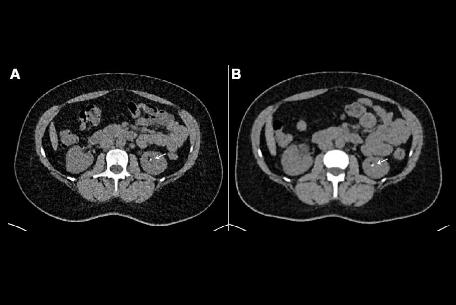 2024 07 30 Radiology Huflage Figure2 Thumbnail