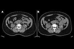 2024 07 30 Radiology Huflage Figure2 Thumbnail