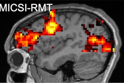 Fmri Sample Cr