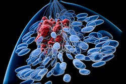 Breast Cancer