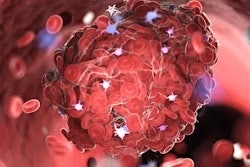 Cytopenia