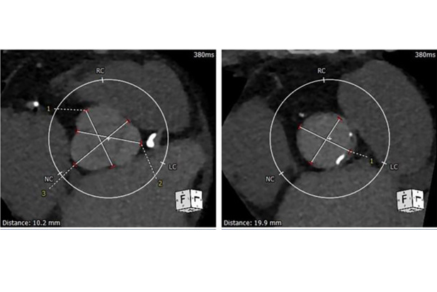 Scct Image1 66997f82bc06b Thumb2