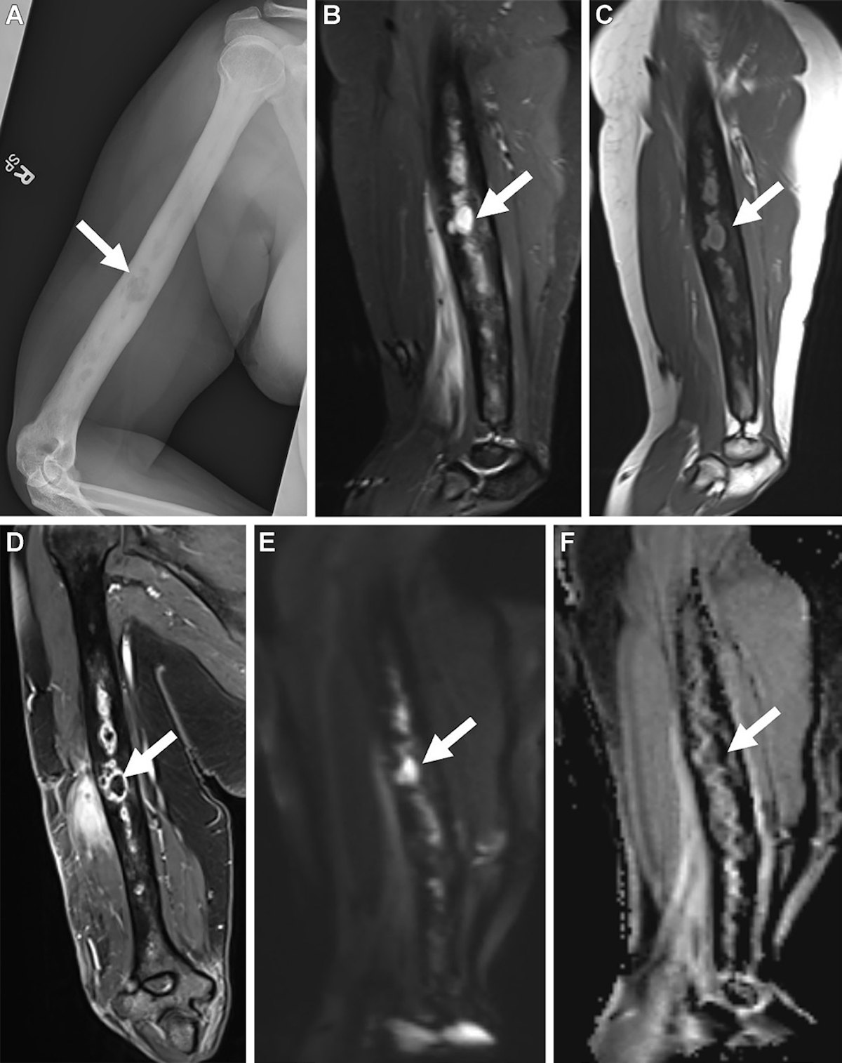 MRIとスポーツ医学 MRI - 独立行政法人国立病院機構 長崎医療センター