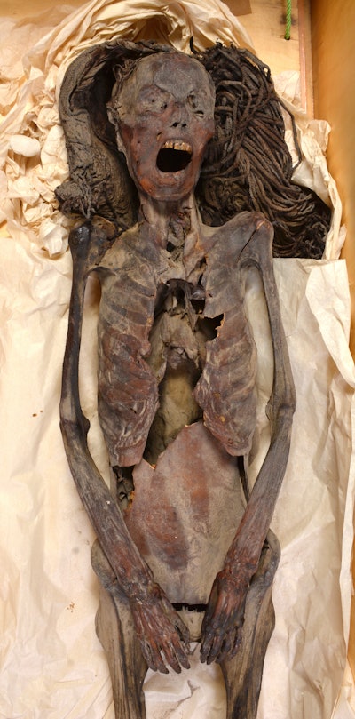 Full view of the 'Screaming Woman' mummy. All images courtesy of Sahar Saleem, MD.