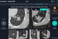 Updated Body Vision Medical AI Tomo with larger field of view. Image courtesy of Body Vision Medical.