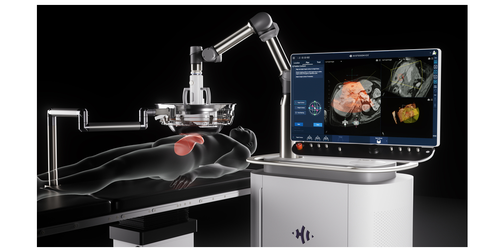 HistoSonics Edison Histotripsy System.