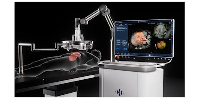 HistoSonics Edison Histotripsy System.