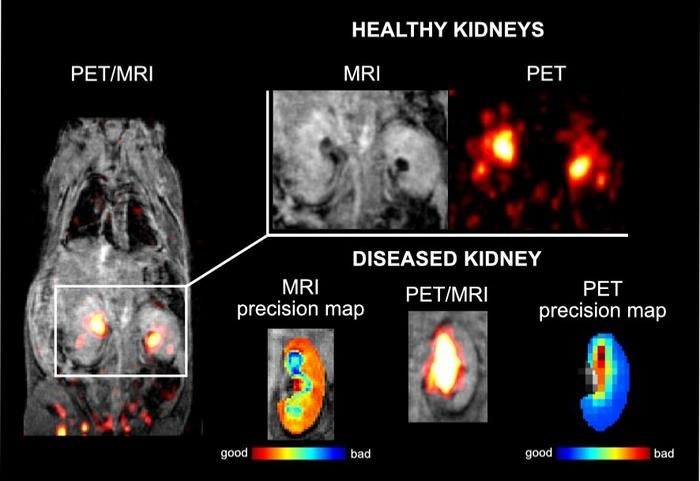 Researchers test dual PET/MRI imaging agent in mice | AuntMinnie