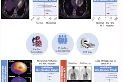A graphical abstract of the study. Image courtesy of JACC: Cardiovascular Imaging.