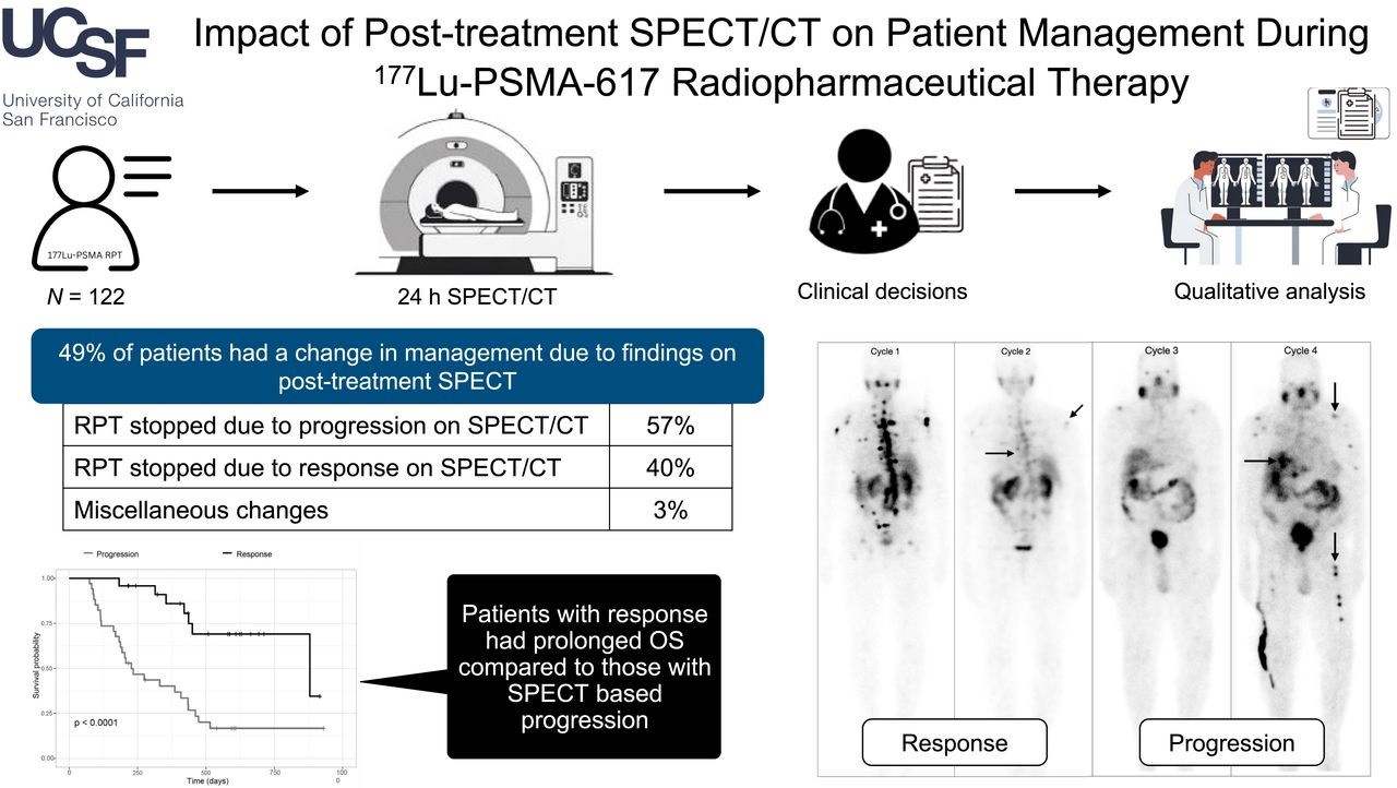 SPECT/CT improves management of Pluvicto patients | AuntMinnie