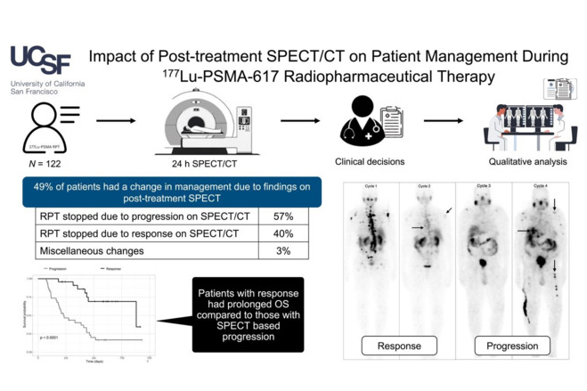 Spect Pluvicto Response Thumbnail