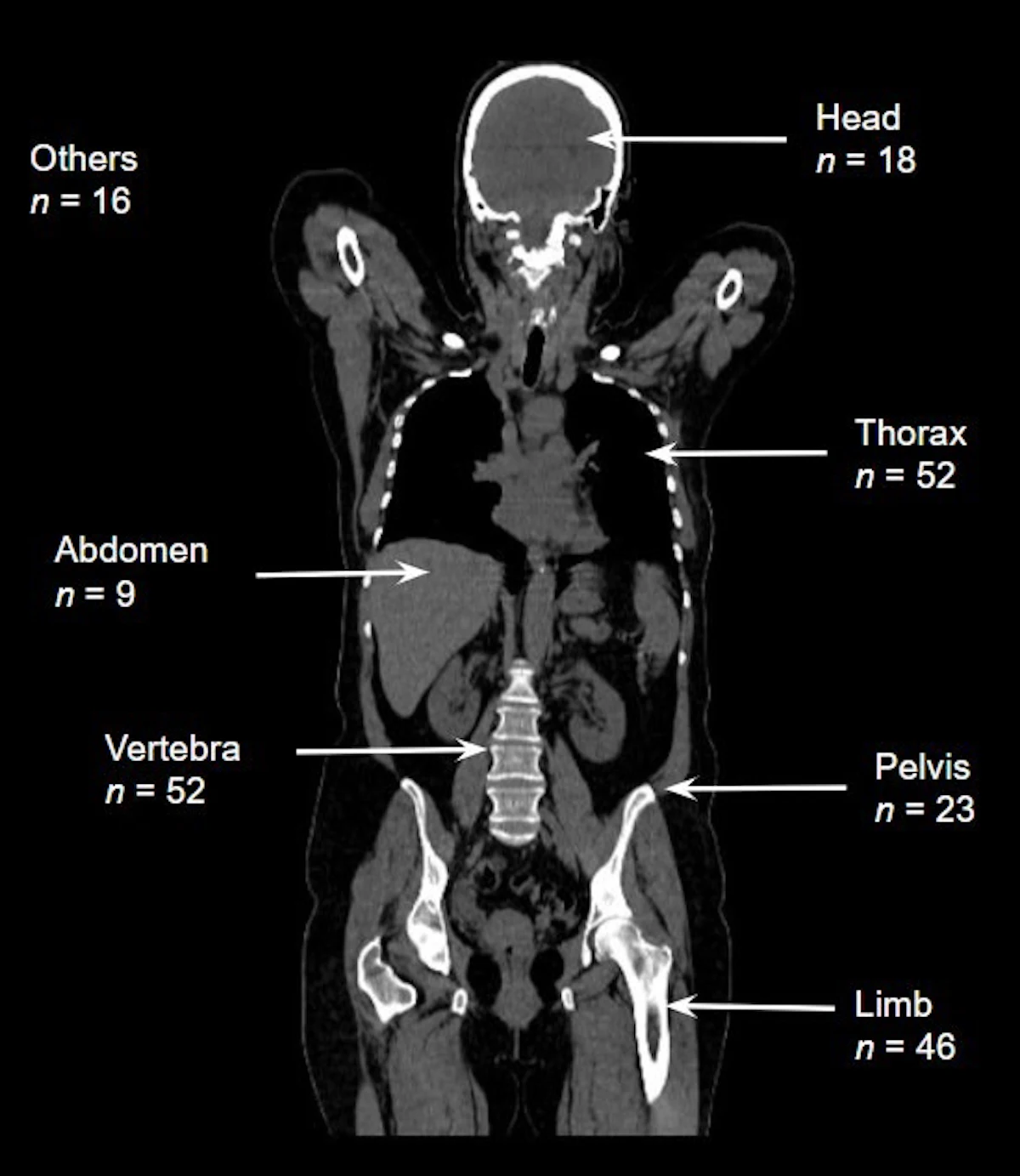 Radiologists in Türkiye describe the consequences of the earthquakes that occurred in 2023