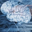 Brain Tracers