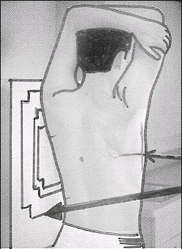 Left lateral chest position. Image courtesy of Dr. Naveed Ahmad.