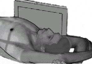 In a lateral decubitus projection, the patient is adjusted in a true supine position with their arms above their head. If the side of pathology is specified, that side should be against the grid. Image courtesy of Dr. Naveed Ahmad.