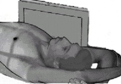 In a lateral decubitus projection, the patient is adjusted in a true supine position with their arms above their head. If the side of pathology is specified, that side should be against the grid. Image courtesy of Dr. Naveed Ahmad.