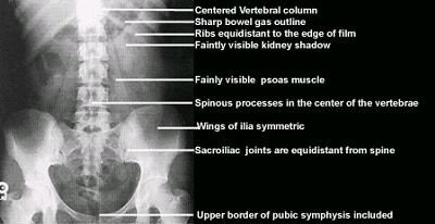 AP abdominal image showing important evaluation criteria. Image courtesy of Dr. Naveed Ahmad.