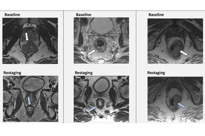 2024 09 03 Images Medium Radiol 232748 fig1 Thumbnail