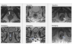 2024 09 03 Images Medium Radiol 232748 fig1 Thumbnail