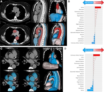 Examples of images in participants who underwent low-dose chest CT for lung cancer screening with cardiovascular structures identified at high risk of mortality, with red indicating the structure with the highest risk score, pink indicating structures with an increased risk score, and blue indicating structures with a low risk score. (A) Axial (left) and sagittal (middle) low-dose CT scans, with corresponding deep learning structure segmentation (bottom), and three-dimensional reconstructions (right) of segmented and ranked structures in a 64-year-old female participant show an aortic aneurysm (cross-sectional diameter of ascending aorta is 51 mm and descending aorta is 43 mm). (B) Waterfall plot in the same participant shows the aorta (red arrow) contributed most to death probability compared with other segmented structures. The participant died of a thoracic aortic aneurysm rupture 5 years after trial randomization. (C) Axial low-dose CT images (left, middle), with corresponding deep learning structure segmentation (bottom), and three-dimensional reconstructions (right) of segmented and ranked structures in a 62-year-old female participant show coronary artery calcifications in the right coronary artery and left descending artery. (D) Waterfall plot in the same participant shows coronary artery calcium (red arrow) contributed most to predicting mortality compared with other segmented structures. The participant died 2 years and 2 months after randomization because of acute myocardial infarction.