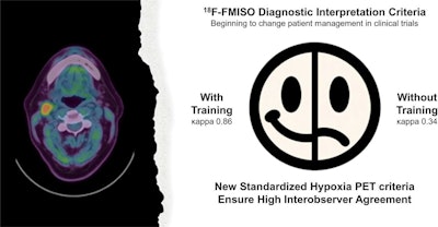 NYC researchers propose criteria for FMISO-PET imaging
