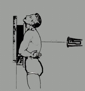 Posteroanterior (PA) chest projection position, patient against chest board. Image courtesy of Dr. Naveed Ahmad.