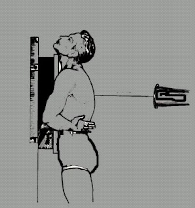 Good positioning is key to PA chest x-ray exams | AuntMinnie