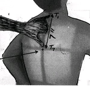 Hand-spread method for central ray positioning utilizing the vertebra proinans. Image courtesy of Dr. Naveed Ahmad.