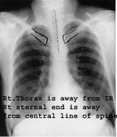 PA view with rotation. Image courtesy of Dr. Naveed Ahmad.