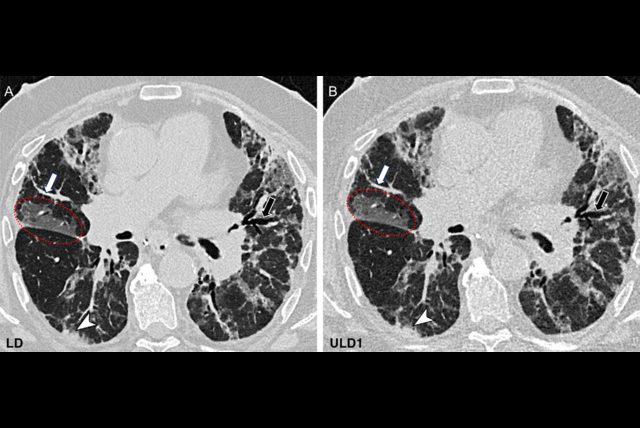 Pct 66e081f76316a Thumbnail