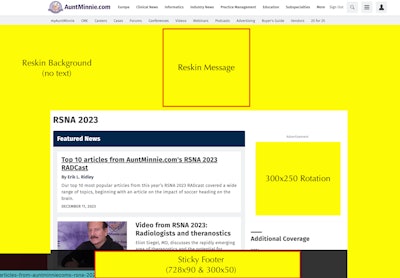 Radcast1