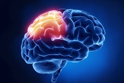 Brain