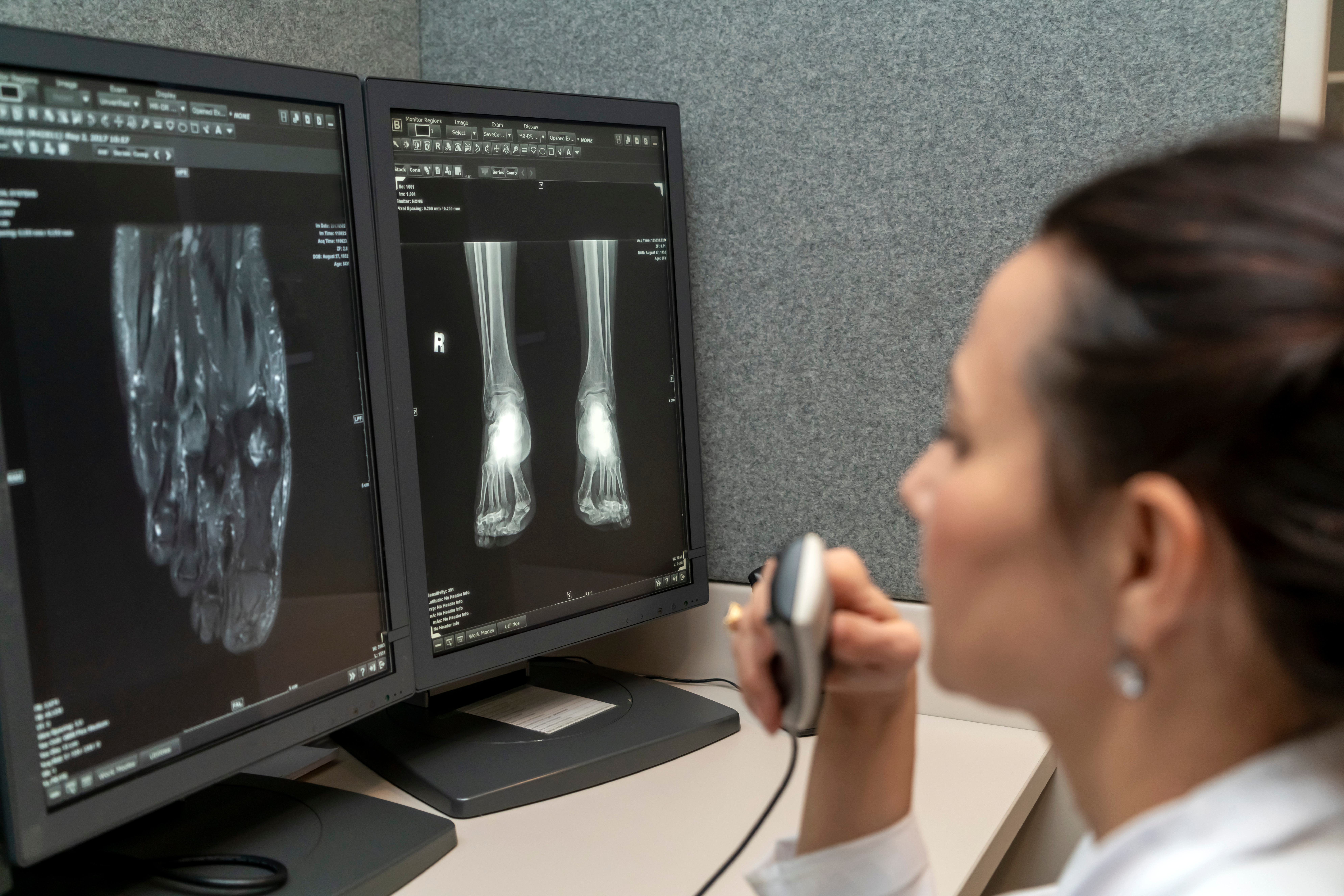 Radiologist Computer Screen X Ray