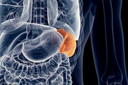 Spleen 400