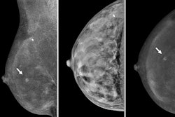 2024 10 01 Radiology Cem Thumbnail