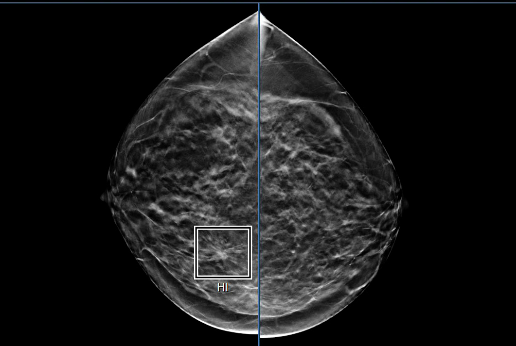 2024 10 16 Deep Health Screenshot Breast