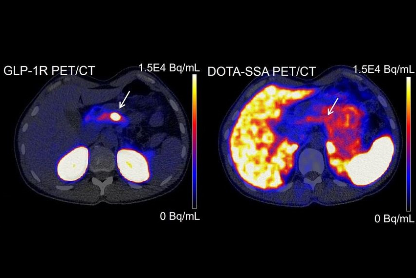 Glp 1 R Pet 67169a712e569 Thumbnail