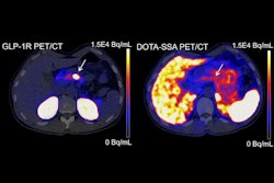 Glp 1 R Pet 67169a712e569 Thumbnail