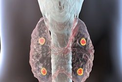 Hyperparathyroidism