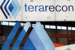 Terarecon