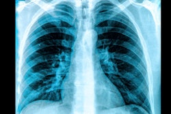 X Ray Chest Lungs Social