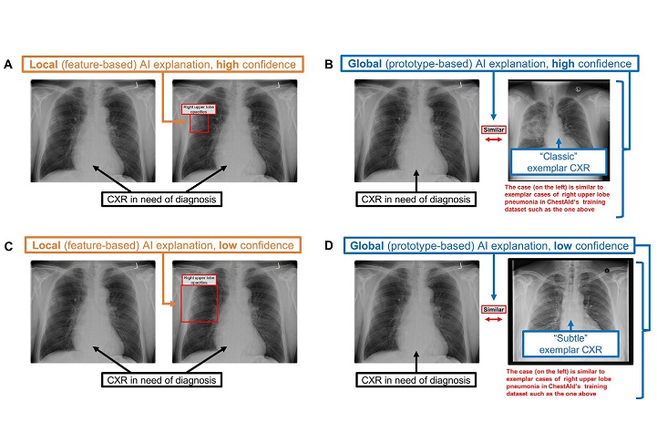 Ai Explainability2 673bc0b7a0c1f Thumbnail
