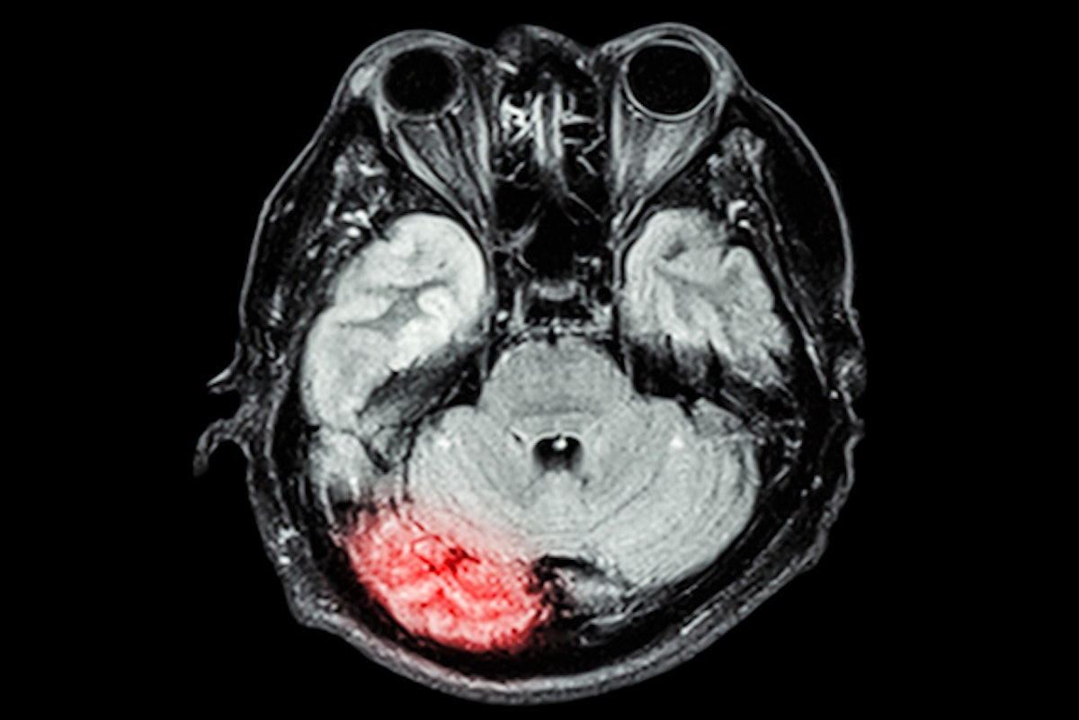 Hyperfine secures CE marking for Swoop portable MRI system