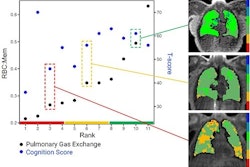 Individuals in the study were plotted with the x-axis being rank of pulmonary gas exchange. The black dots show the pulmonary gas exchange ratio (red blood cell to tissue plasma ratio, RBC:mem) on the left y-axis and the blue dots are the cognition scores on the right y-axis. Gas exchange maps of three representative patients from a low, medium, and high pulmonary gas exchange. Image courtesy of RSNA.