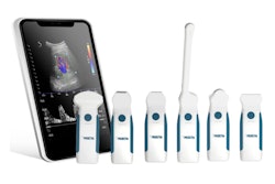 Pocket Vu Ultrasound Super Sonic Imagine Rsna 2024