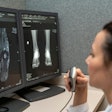 Radiologist Computer Screen X Ray
