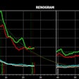 Results of a renogram displayed by the Hybrid Viewer 7.0 software.