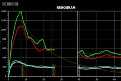 Results of a renogram displayed by the Hybrid Viewer 7.0 software.