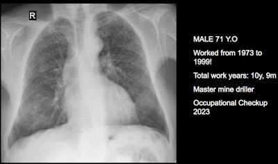 2024 12 04 Peru New Figure 3