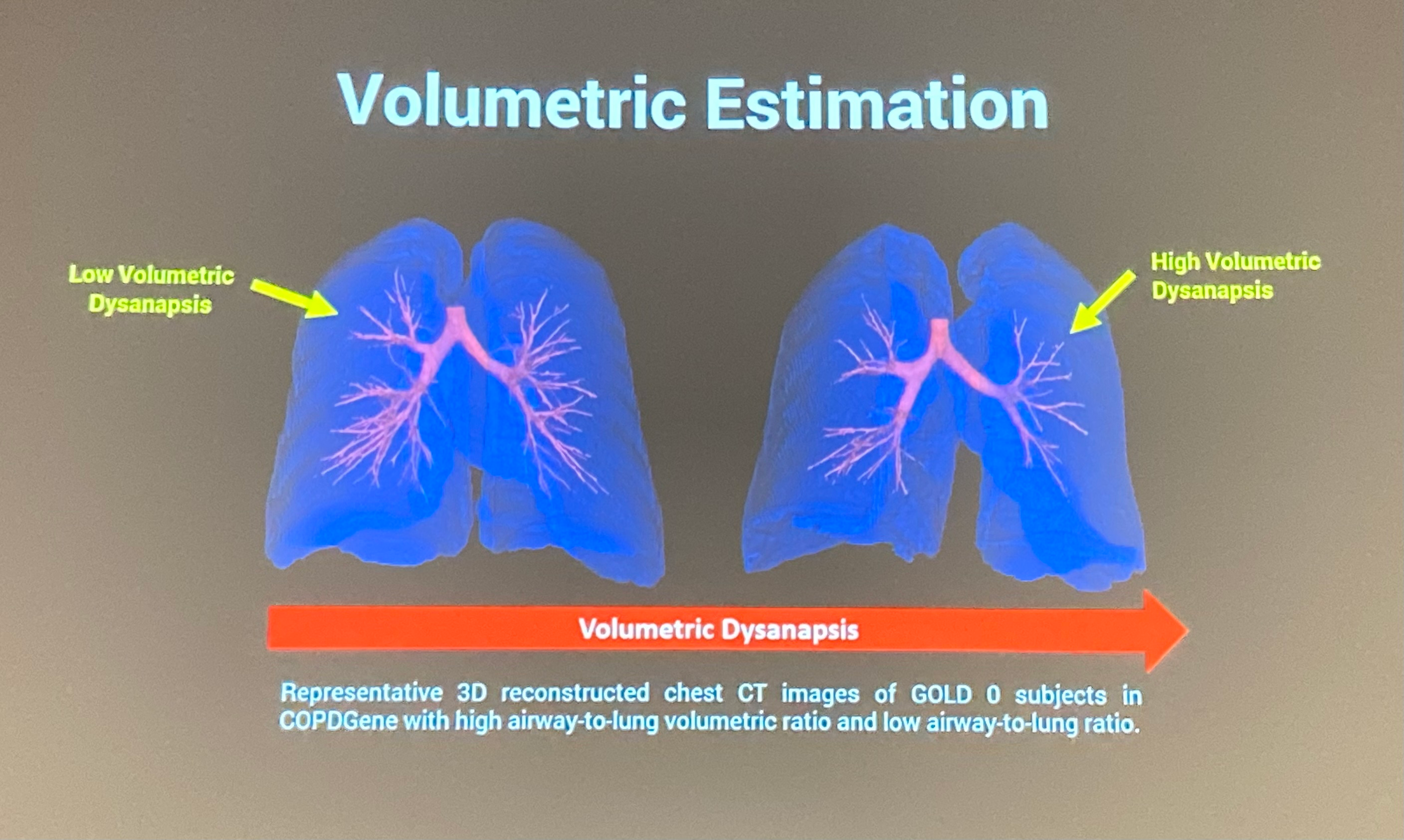 Lung Disease Aguilera Rsna